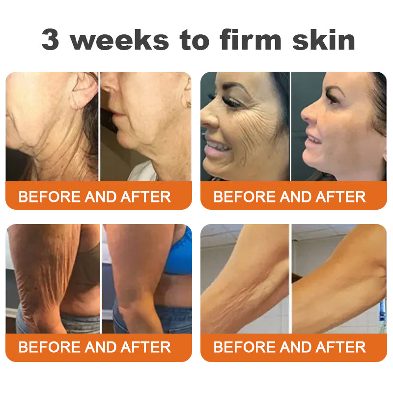 Made and Shipped from USA✨Annranic® Botox Bee Venom Firming Serum Stick(🔥LAST DAY 70% OFF)💄