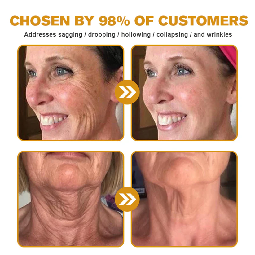 ANNRAINC™ 🐝Bee Poison Skin Restoration Cream 🐝（🔥LAST DAY SALE-80% OFF)🥇👩‍⚕️