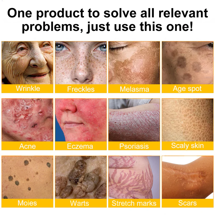 ANNRAINC™ 🐝Bee Poison Skin Restoration Cream 🐝（🔥LAST DAY SALE-80% OFF)🥇👩‍⚕️