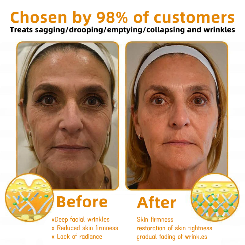 ANNRAINC™ 🐝Bee Poison Skin Restoration Cream 🐝（🔥LAST DAY SALE-80% OFF)🥇👩‍⚕️