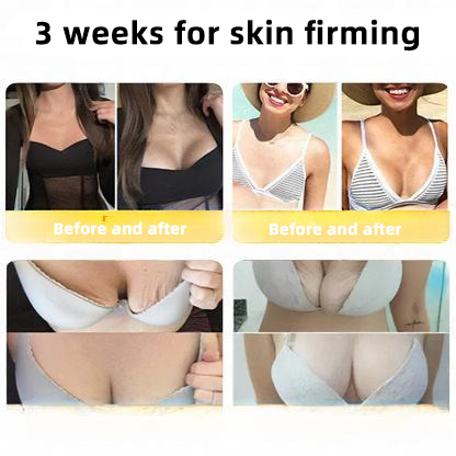ANNRAINC™ 🐝Bee Poison Skin Restoration Cream 🐝（🔥LAST DAY SALE-80% OFF)🥇👩‍⚕️